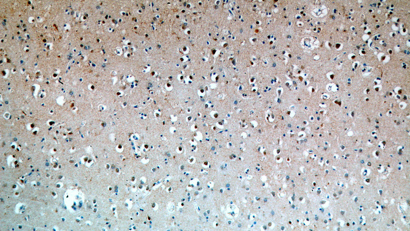 Immunohistochemical of paraffin-embedded human brain using Catalog No:108135(ANAPC4 antibody) at dilution of 1:50 (under 10x lens)