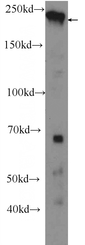HEK-293 cells were subjected to SDS PAGE followed by western blot with Catalog No:109335(CLSPN Antibody) at dilution of 1:300