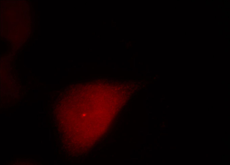 Immunofluorescent analysis of Hela cells, using CETN1 antibody Catalog No:109259 at 1:25 dilution and Rhodamine-labeled goat anti-rabbit IgG (red).
