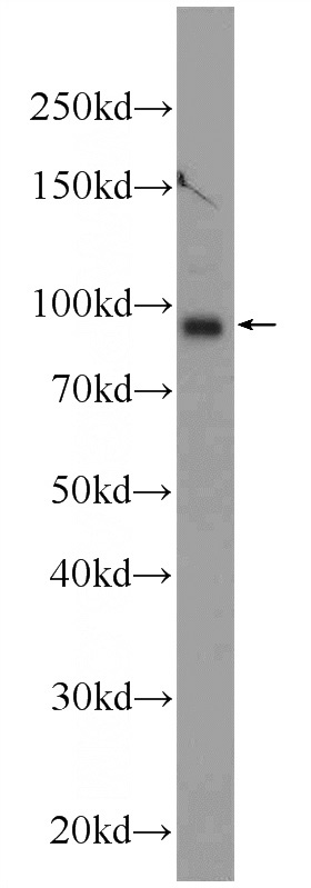 mouse brain tissue were subjected to SDS PAGE followed by western blot with Catalog No:116083(TMCC2 Antibody) at dilution of 1:1000