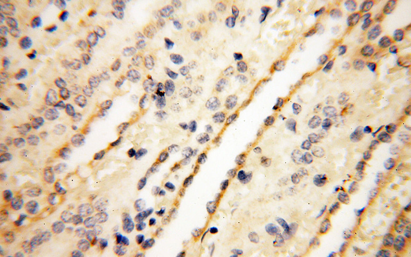 Immunohistochemical of paraffin-embedded human kidney using Catalog No:109345(CLCNKA antibody) at dilution of 1:100 (under 40x lens)