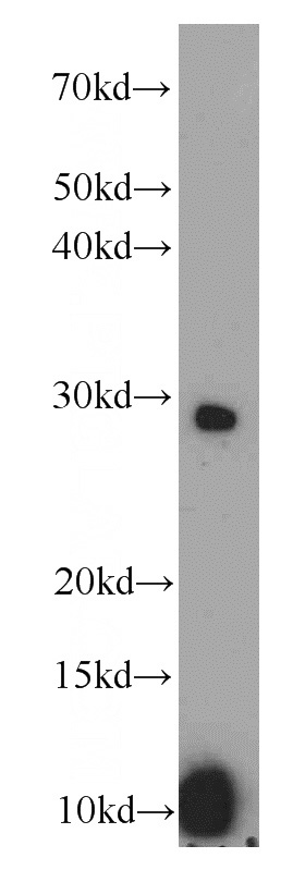 DU 145 cells were subjected to SDS PAGE followed by western blot with Catalog No:107693(ACRV1 antibody) at dilution of 1:4000