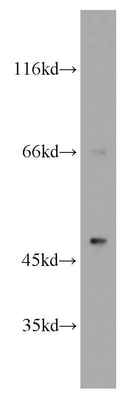 mouse brain tissue were subjected to SDS PAGE followed by western blot with Catalog No:117087(B3GALT2 antibody) at dilution of 1:800