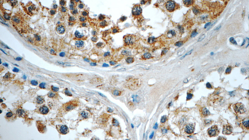 Immunohistochemistry of paraffin-embedded human testis tissue slide using Catalog No:108119(AP2A2 Antibody) at dilution of 1:50 (under 40x lens)