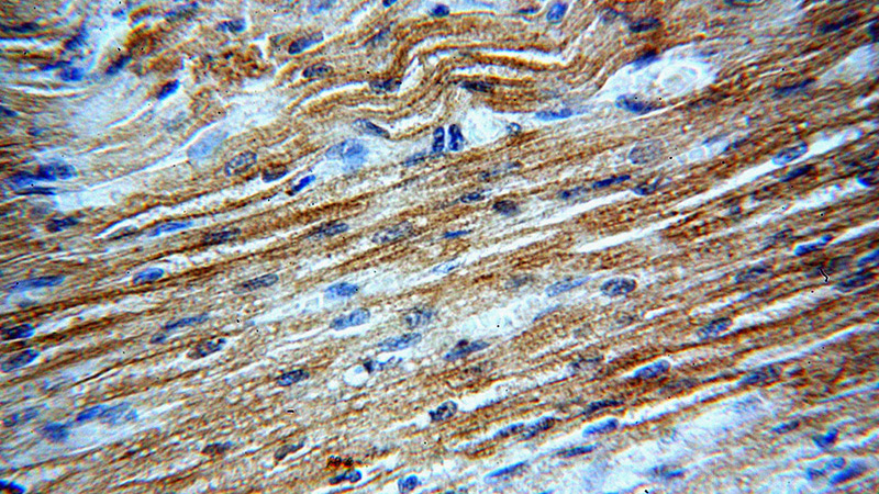 Immunohistochemical of paraffin-embedded human heart using Catalog No:108297(ATG4C antibody) at dilution of 1:50 (under 40x lens)