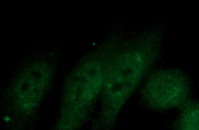 Immunofluorescent analysis of HepG2 cells using Catalog No:113451(NXF1 Antibody) at dilution of 1:50 and Alexa Fluor 488-congugated AffiniPure Goat Anti-Rabbit IgG(H+L)