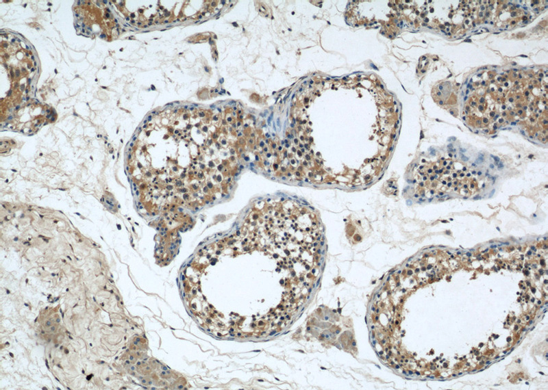 Immunohistochemical of paraffin-embedded human testis using Catalog No:108788(C7orf30 antibody) at dilution of 1:50 (under 10x lens)