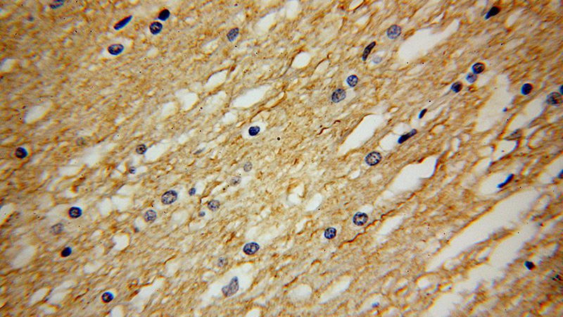 Immunohistochemical of paraffin-embedded human brain using Catalog No:113282(NRSN2 antibody) at dilution of 1:100 (under 40x lens)