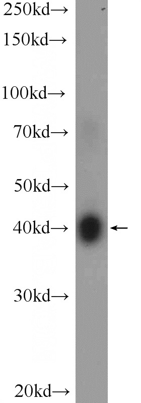 HL-60 cells were subjected to SDS PAGE followed by western blot with Catalog No:116801(VSTM1 Antibody) at dilution of 1:300