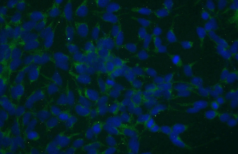 Immunofluorescent analysis of (-20oc Ethanol) fixed HEK-293 cells using Catalog No:115388(SMEK2 Antibody) at dilution of 1:50 and Alexa Fluor 488-congugated AffiniPure Goat Anti-Rabbit IgG(H+L)