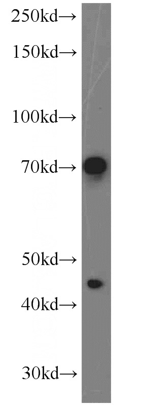 L02 cells were subjected to SDS PAGE followed by western blot with Catalog No:113782(PGCP antibody) at dilution of 1:600