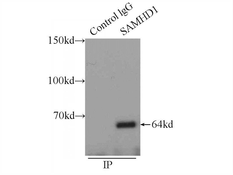 IP Result of anti-SAMHD1 (IP:Catalog No:115056, 3ug; Detection:Catalog No:115056 1:300) with K-562 cells lysate 2400ug.