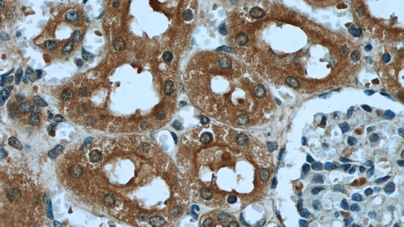 Immunohistochemical of paraffin-embedded human kidney using Catalog No:109865(CD234 antibody) at dilution of 1:50 (under 40x lens)