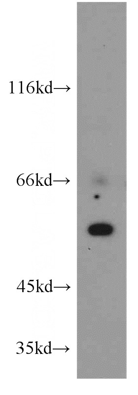 HeLa cells were subjected to SDS PAGE followed by western blot with Catalog No:109687(CYP24A1 antibody) at dilution of 1:300