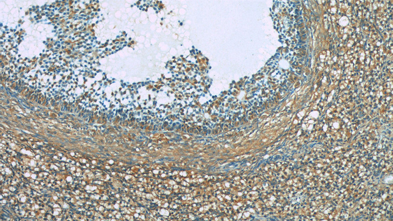Immunohistochemistry of paraffin-embedded human ovary tissue slide using Catalog No:117151(BIVM Antibody) at dilution of 1:50 (under 10x lens)