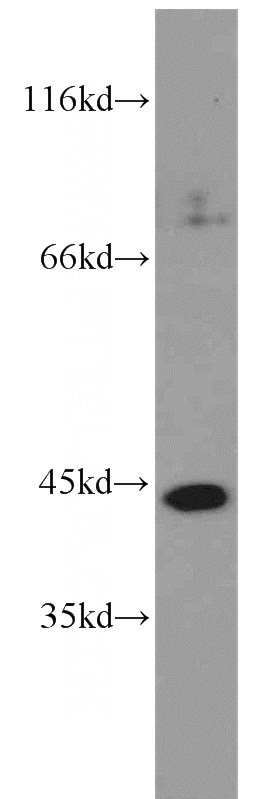 K-562 cells were subjected to SDS PAGE followed by western blot with Catalog No:113498(PAK1IP1 antibody) at dilution of 1:1000