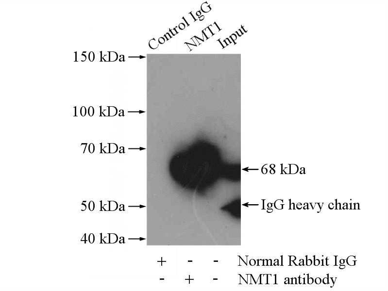 IP Result of anti-NMT1 (IP:Catalog No:113255, 4ug; Detection:Catalog No:113255 1:500) with HeLa cells lysate 2000ug.