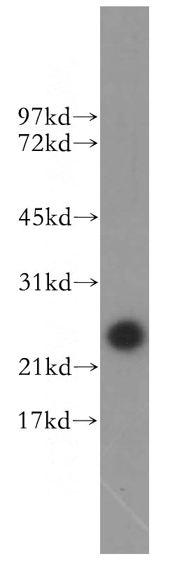 mouse testis tissue were subjected to SDS PAGE followed by western blot with Catalog No:115917(TCP10L antibody) at dilution of 1:200