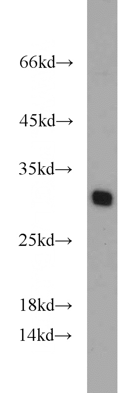 HEK-293 cells were subjected to SDS PAGE followed by western blot with Catalog No:116262(TPD52L2 antibody) at dilution of 1:800