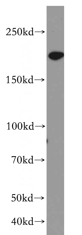 HeLa cells were subjected to SDS PAGE followed by western blot with Catalog No:115428(SMARCA4 antibody) at dilution of 1:300