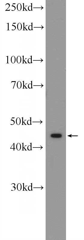 mouse brain tissue were subjected to SDS PAGE followed by western blot with Catalog No:109395(ASAM Antibody) at dilution of 1:600