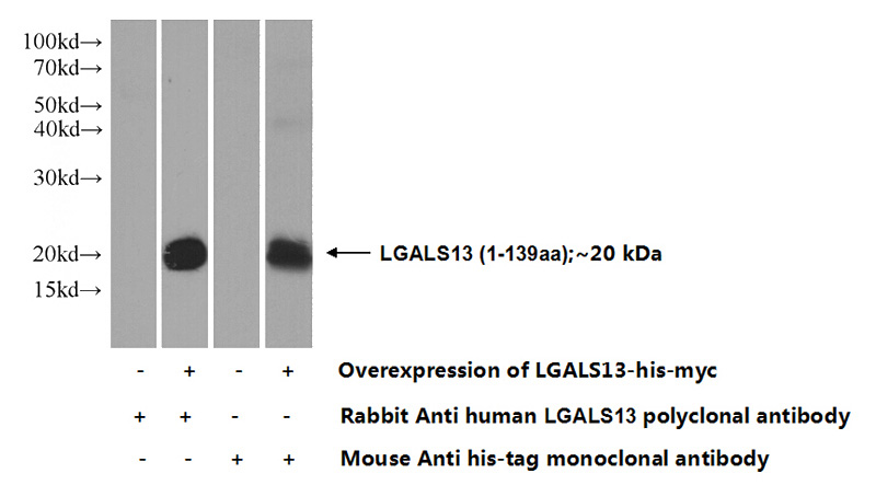Transfected HEK-293 cells were subjected to SDS PAGE followed by western blot with Catalog No:112203(LGALS13 Antibody) at dilution of 1:1000
