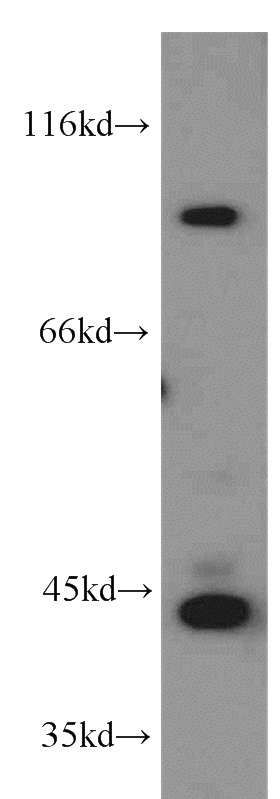SH-SY5Y cells were subjected to SDS PAGE followed by western blot with Catalog No:113927(PLA2G4E antibody) at dilution of 1:1000