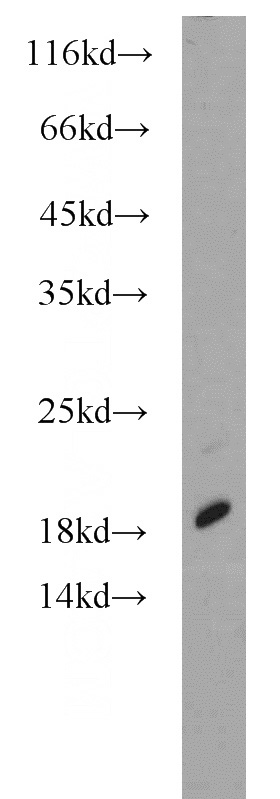 human liver tissue were subjected to SDS PAGE followed by western blot with Catalog No:115591(SRP19 antibody) at dilution of 1:1000