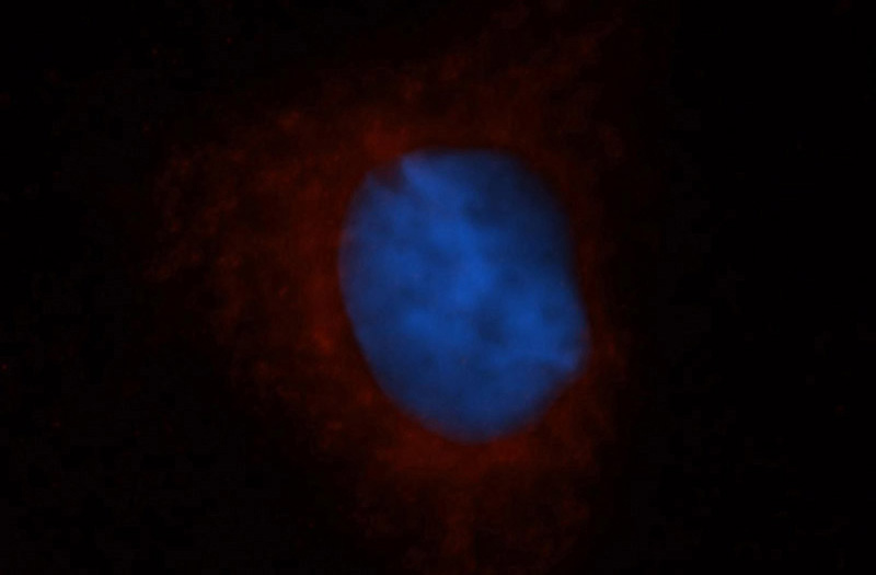 Immunofluorescent analysis of MCF-7 cells, using DHODH antibody Catalog No:109919 at 1:50 dilution and Rhodamine-labeled goat anti-rabbit IgG (red). Blue pseudocolor = DAPI (fluorescent DNA dye).