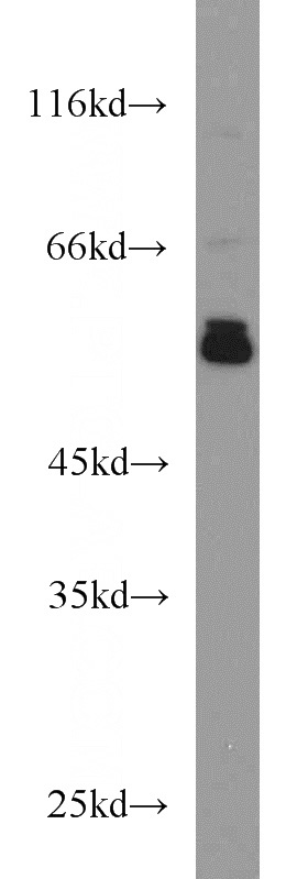 L02 cells were subjected to SDS PAGE followed by western blot with Catalog No:110374(PDIA3 antibody) at dilution of 1:1000