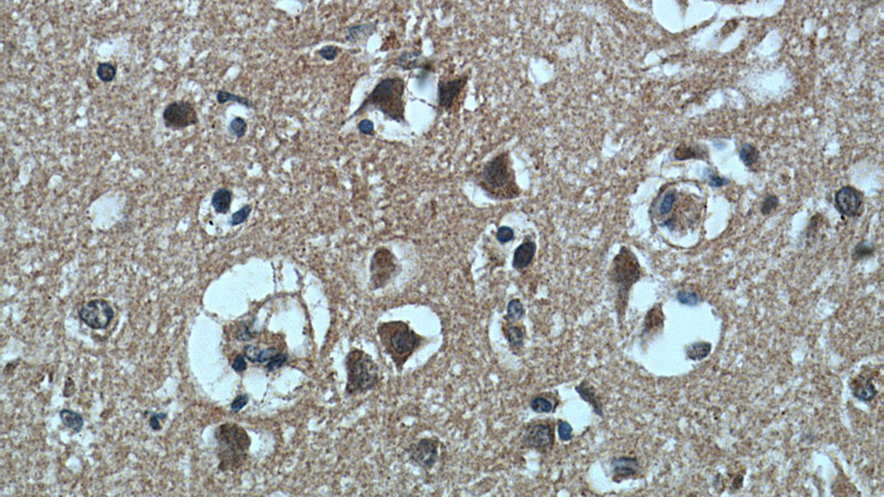 Immunohistochemical of paraffin-embedded human brain using Catalog No:108803(C9orf72 antibody) at dilution of 1:50 (under 40x lens)