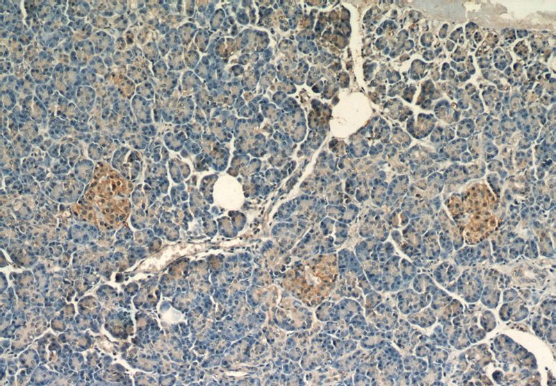 Immunohistochemical of paraffin-embedded human pancreas using Catalog No:113742(PCMT1 antibody) at dilution of 1:50 (under 10x lens)