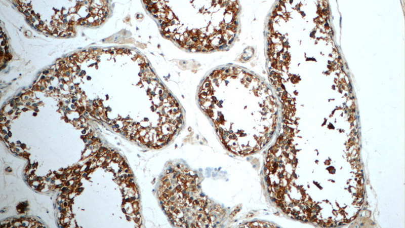 Immunohistochemistry of paraffin-embedded human testis tissue slide using Catalog No:112200(LEP Antibody) at dilution of 1:50 (under 10x lens)