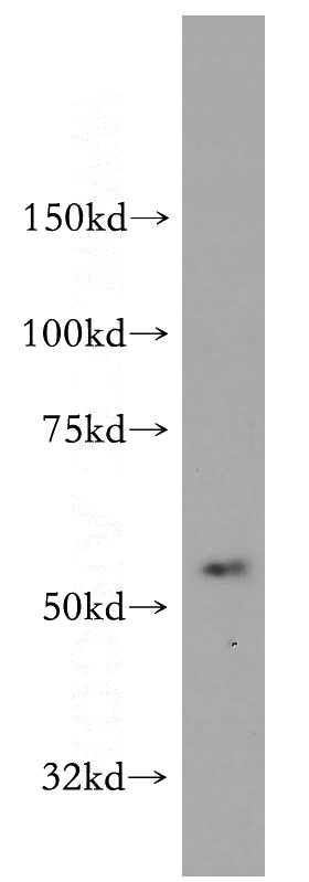 COLO 320 cells were subjected to SDS PAGE followed by western blot with Catalog No:107670(AADACL1 antibody) at dilution of 1:500