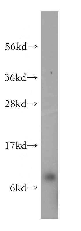 MCF7 cells were subjected to SDS PAGE followed by western blot with Catalog No:114838(RPS27 antibody) at dilution of 1:500