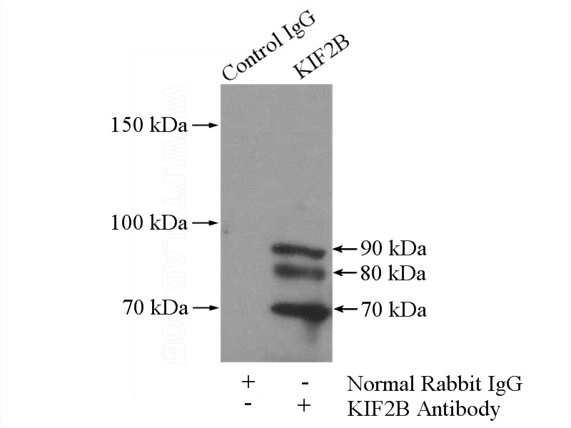 IP Result of anti-KIF2B (IP:Catalog No:112011, 4ug; Detection:Catalog No:112011 1:1000) with mouse testis tissue lysate 4000ug.
