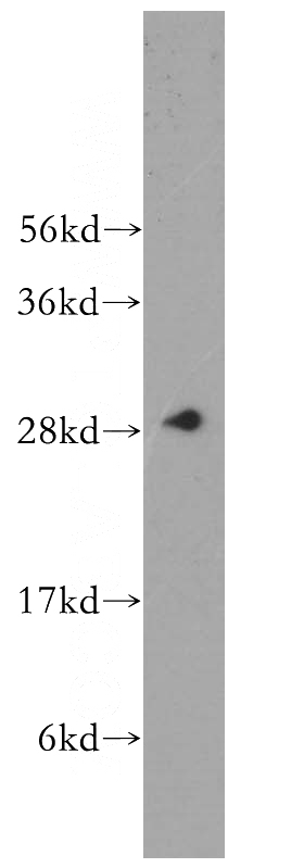 Jurkat cells were subjected to SDS PAGE followed by western blot with Catalog No:108741(CA1 antibody) at dilution of 1:500