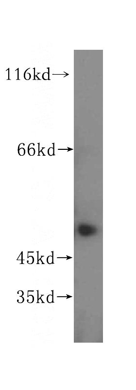 MCF7 cells were subjected to SDS PAGE followed by western blot with Catalog No:114134(PPM1F antibody) at dilution of 1:500