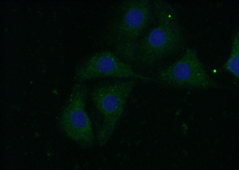 Immunofluorescent analysis of (-20oc Acetone) fixed SH-SY5Y cells using Catalog No:108841(CADPS Antibody) at dilution of 1:50 and Alexa Fluor 488-congugated AffiniPure Goat Anti-Rabbit IgG(H+L)