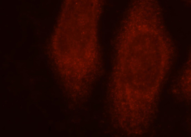 Immunofluorescent analysis of HepG2 cells, using Catalog No:112894 and Rhodamine-labeled goat anti-rabbit IgG (red).