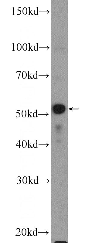 MCF-7 cells were subjected to SDS PAGE followed by western blot with Catalog No:113936(PLAGL1 Antibody) at dilution of 1:600