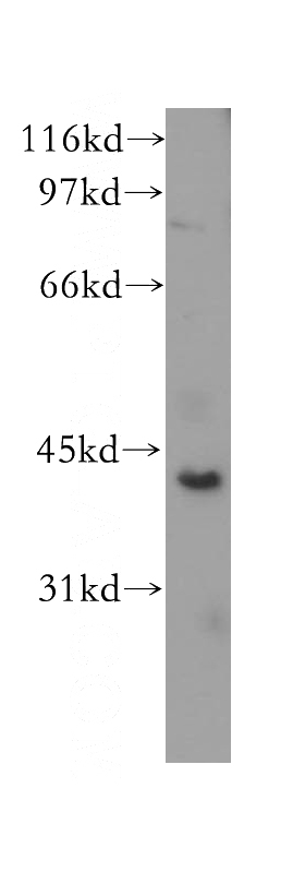 MCF7 cells were subjected to SDS PAGE followed by western blot with Catalog No:109206(CHAD antibody) at dilution of 1:400