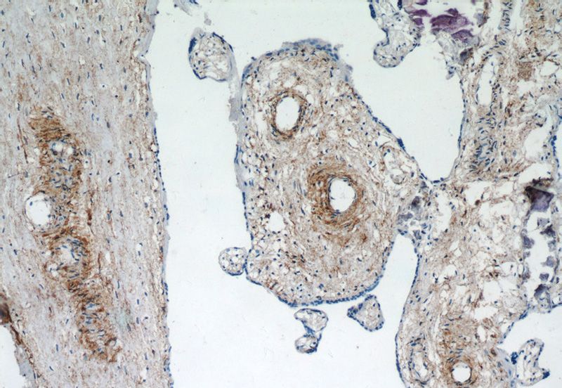 Immunohistochemistry of paraffin-embedded human placenta tissue slide using Catalog No:111927(KCNC4 Antibody) at dilution of 1:50 (under 10x lens)