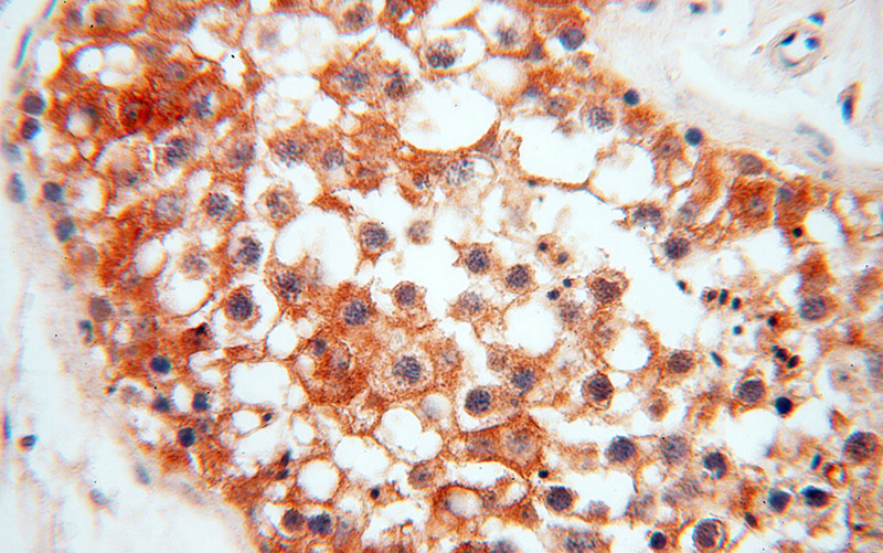 Immunohistochemical of paraffin-embedded human testis using Catalog No:108313(ATP6V1F antibody) at dilution of 1:50 (under 40x lens)