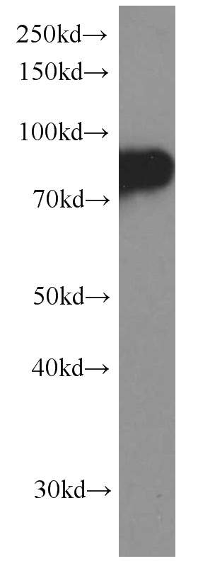 HeLa cells were subjected to SDS PAGE followed by western blot with Catalog No:107143(CD71 Antibody) at dilution of 1:2000