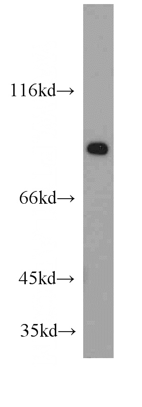 HeLa cells were subjected to SDS PAGE followed by western blot with Catalog No:117251(ZNF839 antibody) at dilution of 1:500