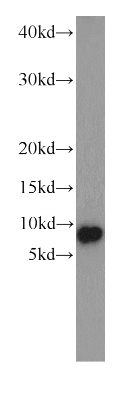 mouse heart tissue were subjected to SDS PAGE followed by western blot with Catalog No:109497(COX7A1 antibody) at dilution of 1:1000