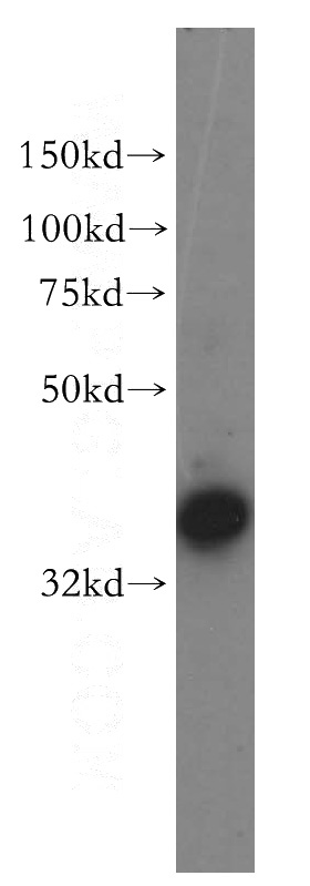 HepG2 cells were subjected to SDS PAGE followed by western blot with Catalog No:112948(NAPG antibody) at dilution of 1:400