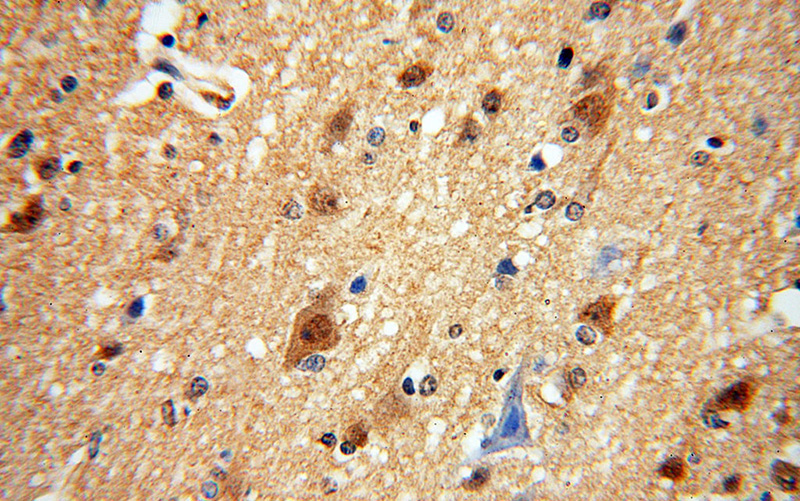 Immunohistochemical of paraffin-embedded human brain using Catalog No:109260(CETN2 antibody) at dilution of 1:50 (under 40x lens)