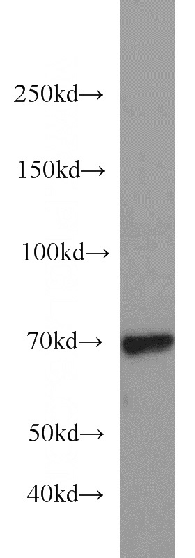 Jurkat cells were subjected to SDS PAGE followed by western blot with Catalog No:113880(PIAS1 antibody) at dilution of 1:1000